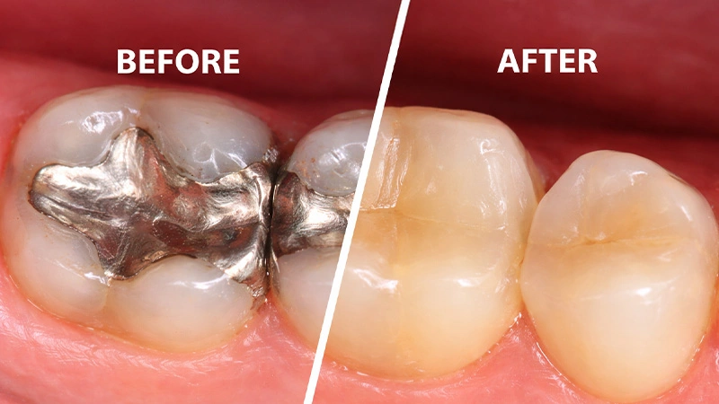 Old Restorations Before and after